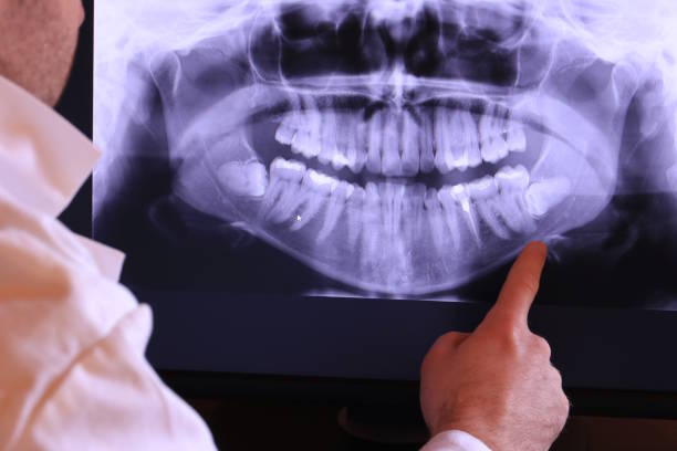 Best Emergency Treatment for Toothache in Westway, TX